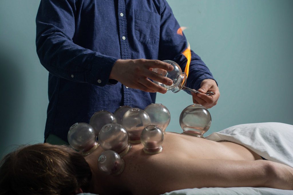 professional performing cupping therapy on a client's back